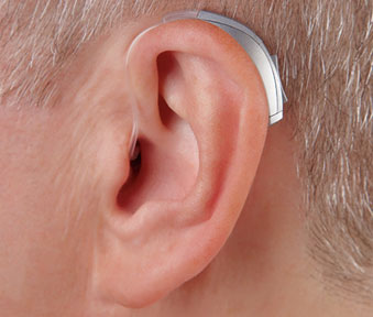 ΒΤΕ (Behind The Ear) – Οπισθωτιαία (πίσω από το αυτί). Εφαρμόζονται πίσω από το αυτί και συνδέονται με το κατάλληλο εκμαγείο.   Γενικά είναι πιο δυνατά και τοποθετούνται και σε πολύ μεγάλου βαθμού βαρηκοΐας.